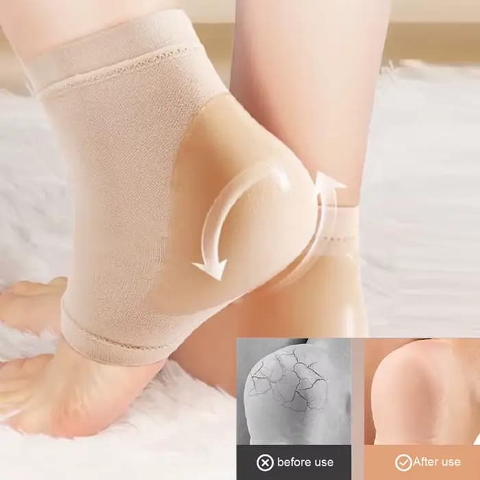 Coussinets de protection en Silicone pour talons
